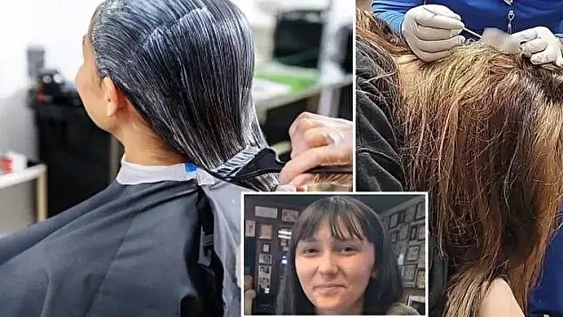 Saçını boyattı başına gelmeyen kalmadı: Genç kızın kafasında delik açıldı