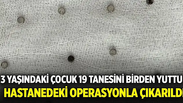 3 yaşındaki çocuk 19 tanesini birden yuttu: Hastanedeki operasyonla çıkarıldı