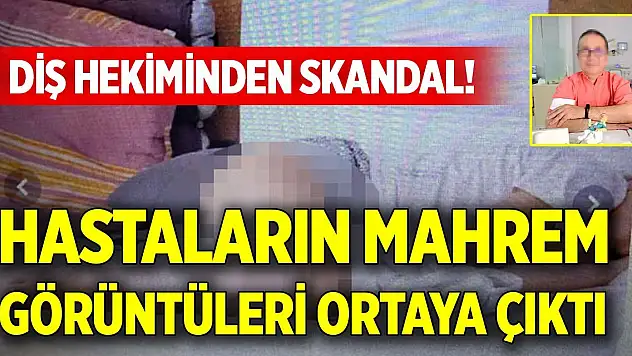 Diş hekiminden skandal! Hastaların mahrem görüntüleri ortaya çıktı