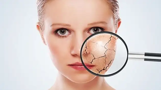 Cildiniz için kışa hazırlık reçetesi