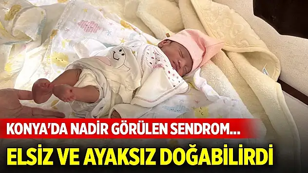 Konya'da nadir görülen sendrom... Elsiz ve ayaksız doğabilirdi