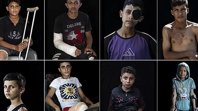 Gazze'de 5 bini aşkın çocuk ampute edildi