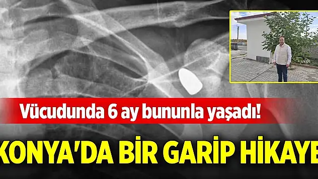 Vücudunda 6 ay bununla yaşadı! Konya'da bir garip hikaye