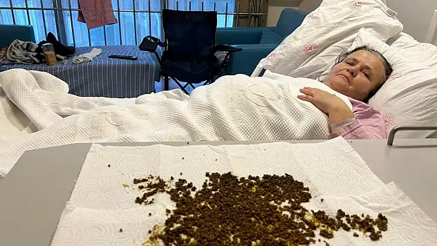 Bu bir rekor! Hastadan çıkan taşları sayamadılar