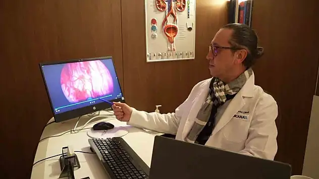 50 yaş üstü erkeklerde prostat tedavisinde en etkili yöntem: Holep