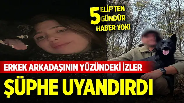 Elif'ten 5 gündür haber yok! Erkek arkadaşının yüzündeki izler şüphe uyandırdı