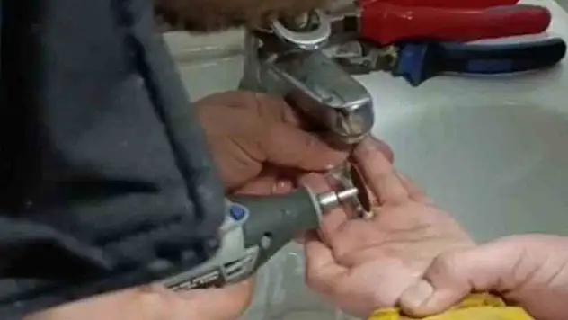 Parmağını metal paraya sıkıştırdı