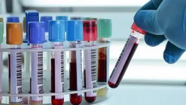 Artık Türkiye'de üretilecek