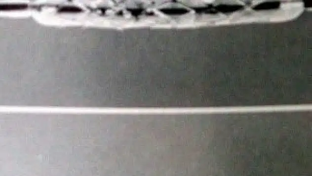 'Yeni stent teknolojisi geniş tedavi imkanı sağlıyor'