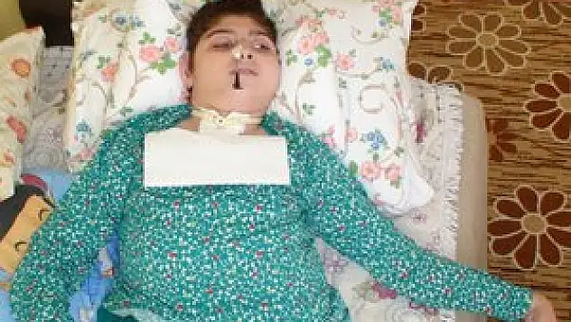 14 yaşındaki engelli Gülce burnundan besleniyor