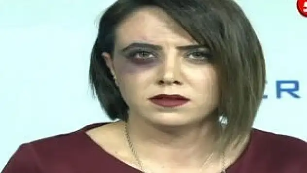 Spiker haber bültenine morarmış gözle çıktı