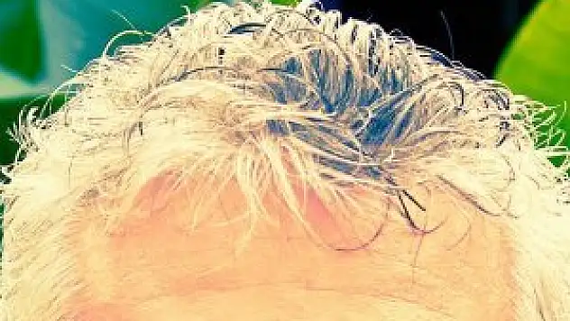 Kalp damar hastalıkları saçlara ak düşürüyor