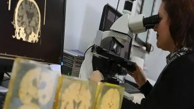 Alzaymırın gizemi İzmir'deki 'Beyin Bankası'nda çözülecek