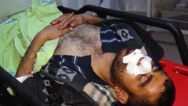 Motosiklet sürücüsü hindiye çarpmamak için kaza yaptı