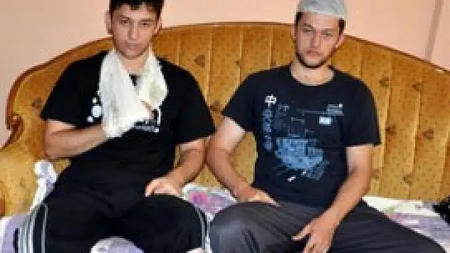 Hayalleri için 20 dikişi saçının üzerinden attırdı