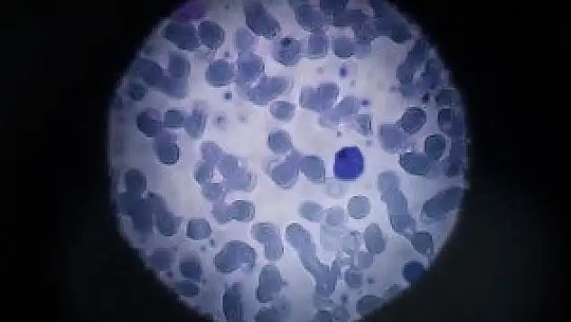 Zika virüsü Avustralya'ya ulaştı