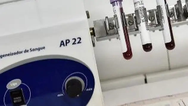 'Zika virüsü, kafatası küçük bebeklere yol açıyor'