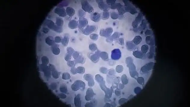 Sağlık Bakanlığından 'Zika virüsü' broşürü