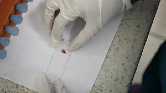 Küba'da zika virüsüyle mücadele