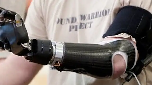 Düşünce gücüyle çalışan protez kol!