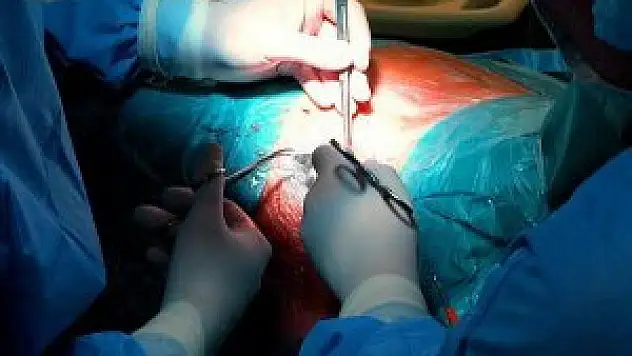 Türler arası organ naklinde ilerleme kaydedildi