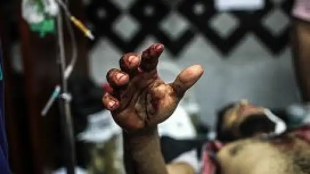 Dünya katliamı kınadı