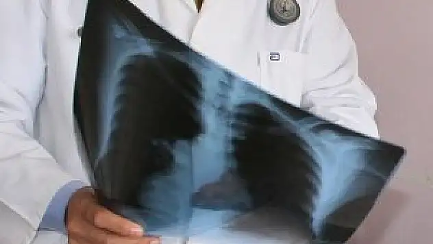 'İnce ve light sigara akciğer kanserinin seyrini hızlandırıyor'