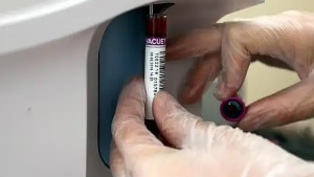 Japon bilim adamları elektronik deri cihazını geliştirdi