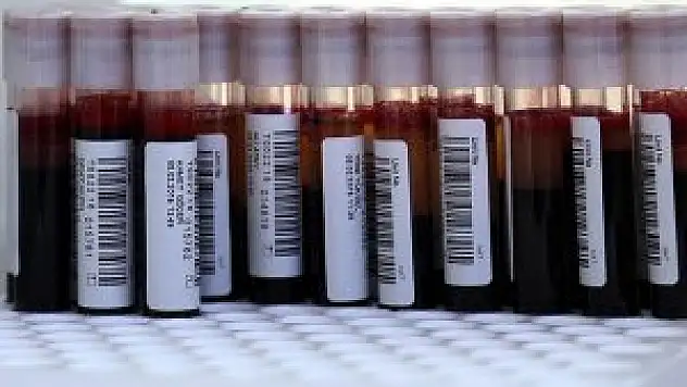 'Yıllık kan ihtiyacı 2 milyon ünitenin üzerinde'