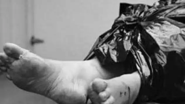 Konya'da, çöplükte yanmış erkek cesedi bulundu