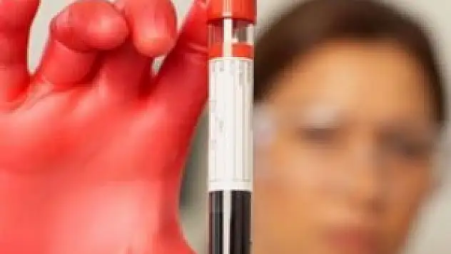 Kan testi ile kanser teşhisi mümkün mü?