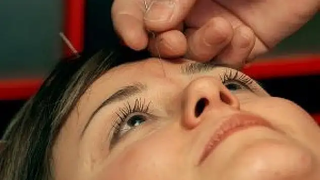 Depresyon ve bağımlılık tedavisine doğal destek: Akupunktur