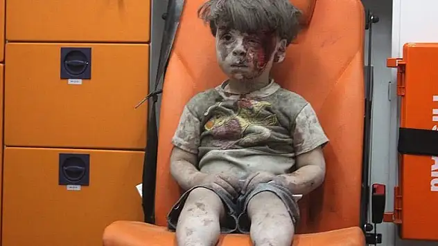 Halep'li 5 yaşındaki ''Ümran Daknes''in dramı herkesi etkiledi