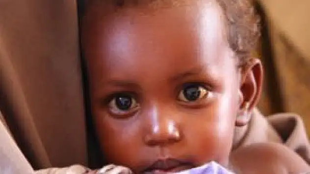 Şimdi ise Türk doktorları bekliyoruz!