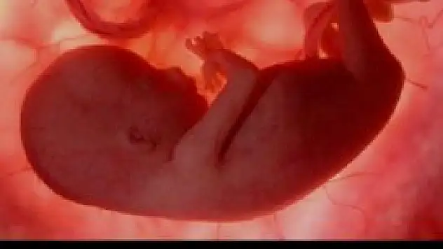 Anne karnındaki bebeğe hayat operasyonu