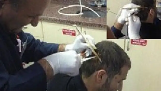 Kafasına odun saplandı