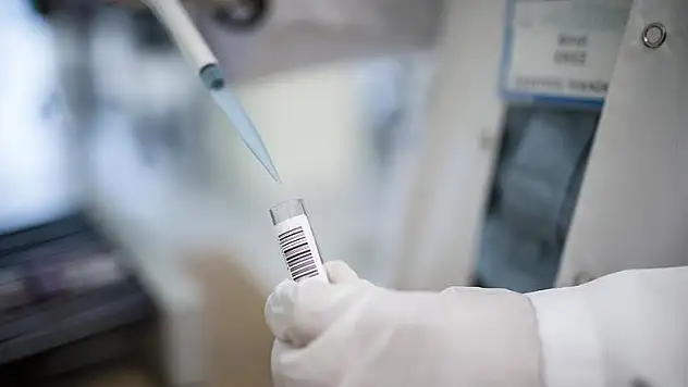 Alzaymırı tedavi eden molekül bulundu