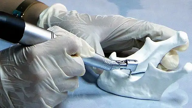 'İmplantlar da diş gibi bakım ister'