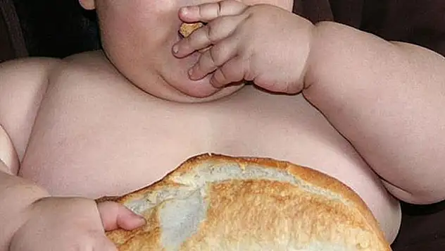 'Çocukluktaki obezite erişkinlikte de risk oluşturuyor'