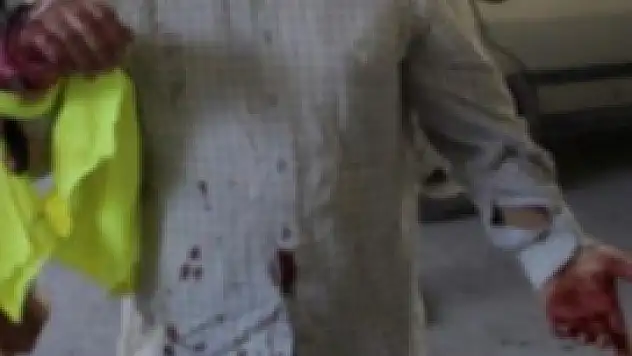 Acemi kasaplar hastaneleri doldurdu