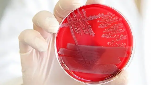 Bazı virüsler kadınları erkeklerden daha az etkiliyor