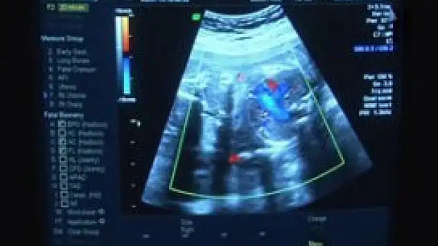 Anne karnındaki bebeğe böbrek ameliyatı