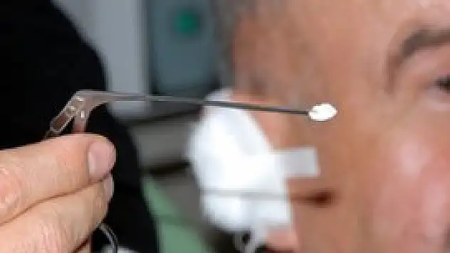 Sigara kağıdıyla kulak zarı tedavisi