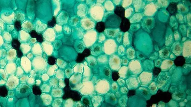 Yaşlanmayla ilgili protein keşfedildi