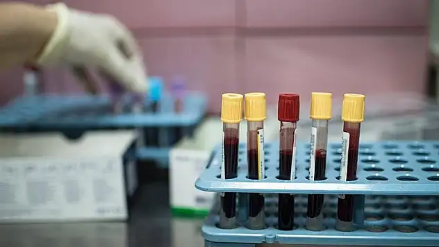 'Kanser Türkiye'de ikinci ölüm nedeni'