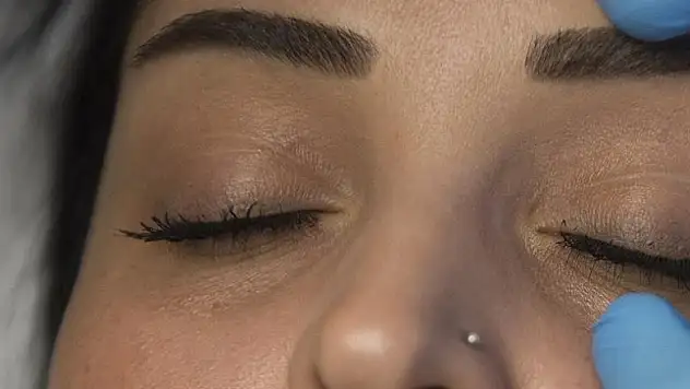 'Göz kapağı estetiği uzmanınca yapılmalı'