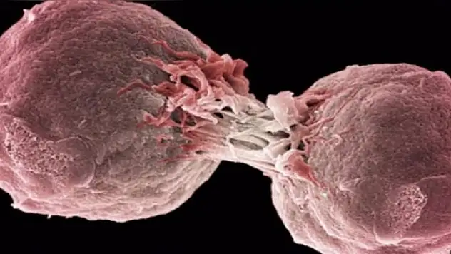 DSÖ uyardı Kanserden daha tehlikeli