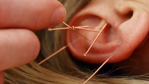 Devlet hastanesinde akupunktur dönemi