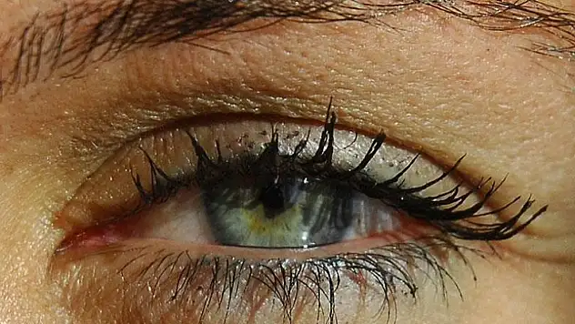 'Glokom sinsi seyrediyor'