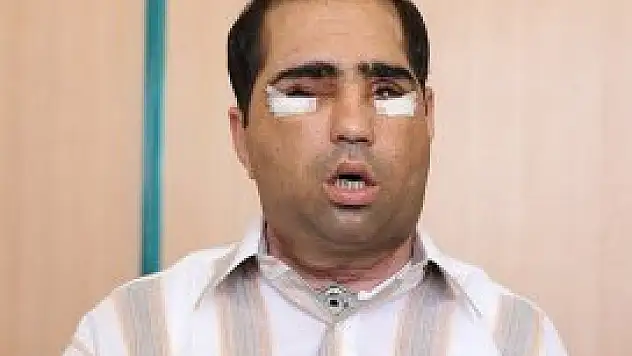 Artık her şeyin tadını alabiliyor